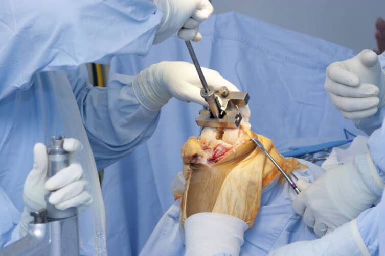 Χειρουργική οστεοαρθρίτιδας γόνατος