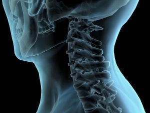 Μέθοδοι διάγνωσης της οστεοχόνδρωσης του λαιμού